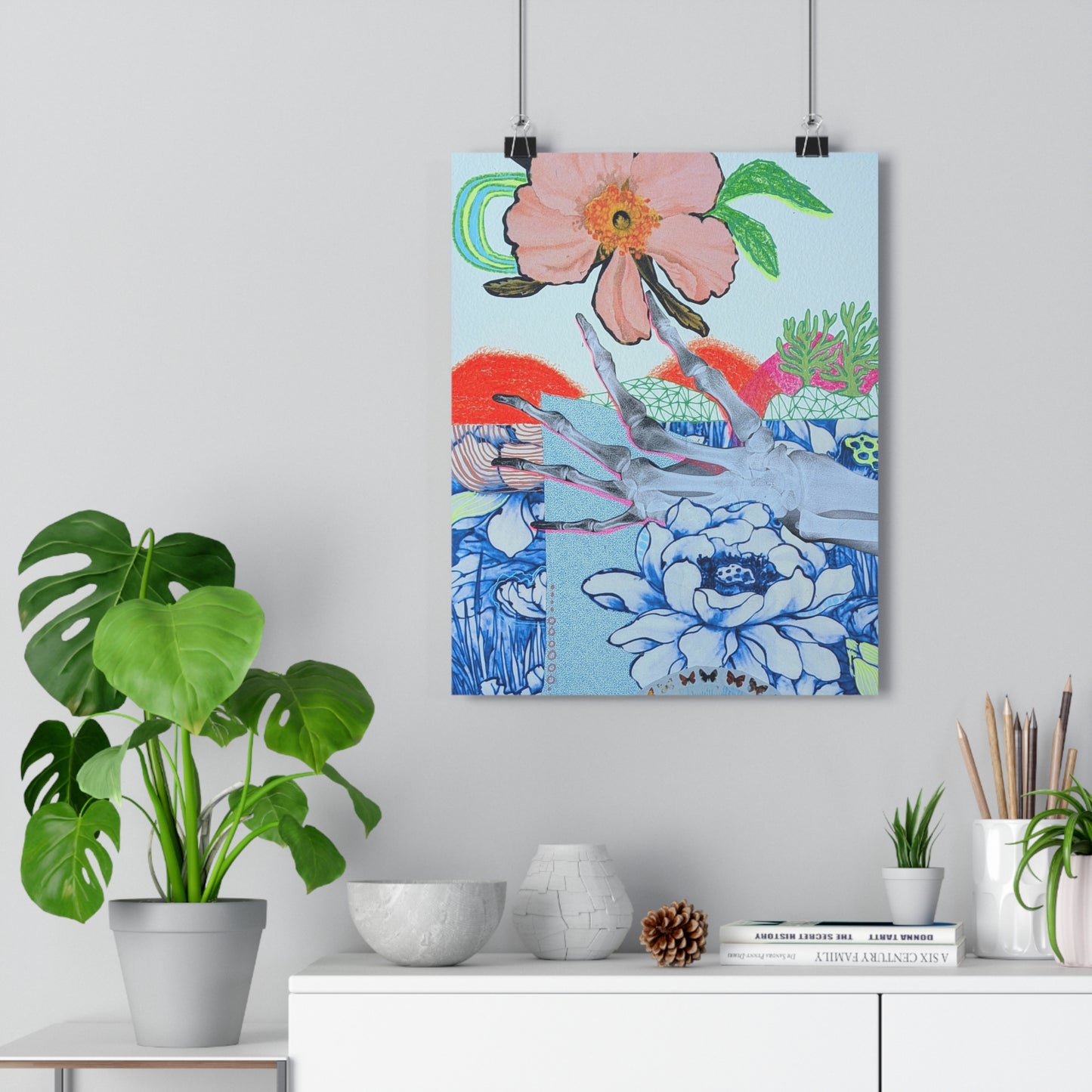 X-Ray (Mixed Media Collage Fine Art Giclee Print)