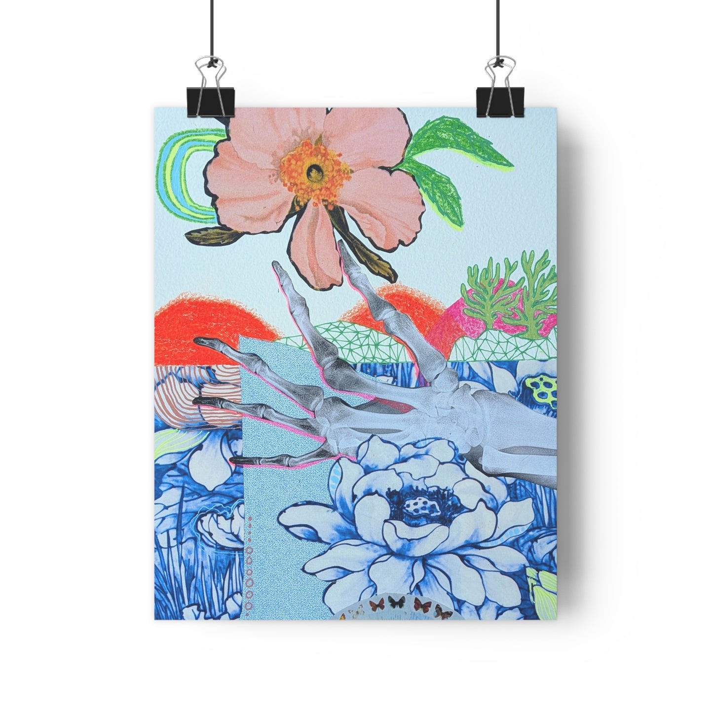 X-Ray (Mixed Media Collage Fine Art Giclee Print)