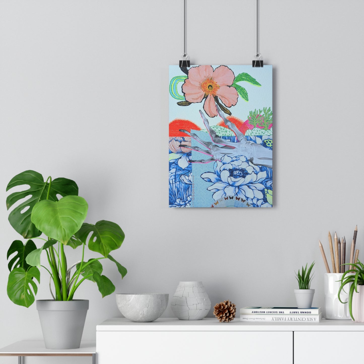X-Ray (Mixed Media Collage Fine Art Giclee Print)