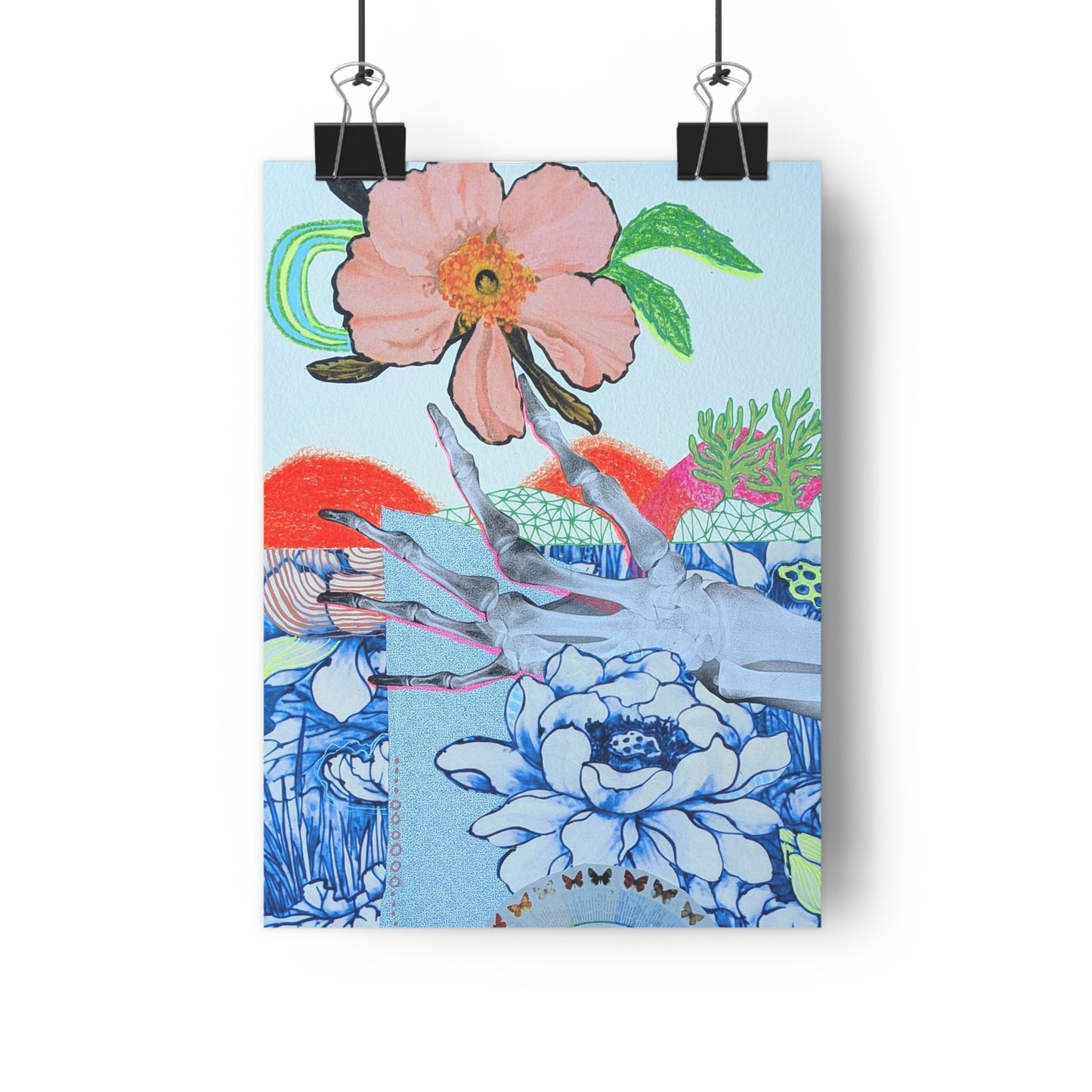 X-Ray (Mixed Media Collage Fine Art Giclee Print)